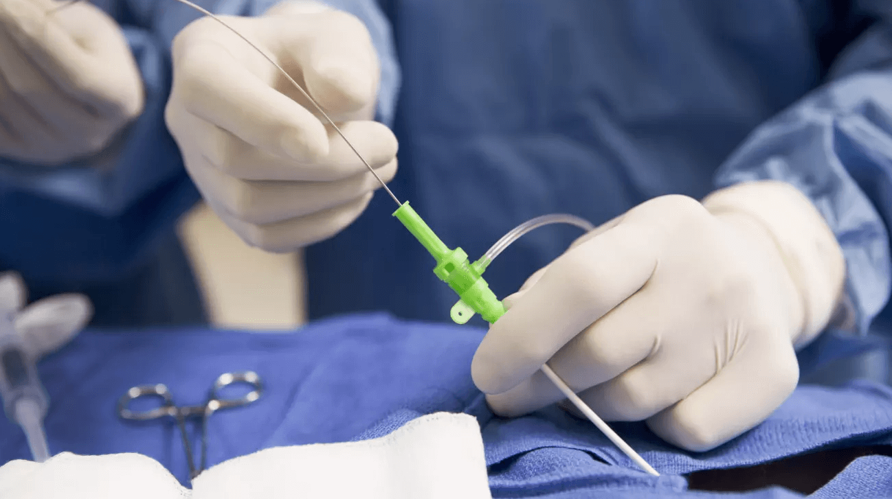 reparación endovascular del aneurisma (EVAR)